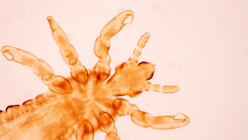 photo of head lice