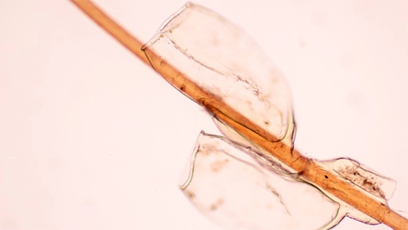 photo of a head lice eggs