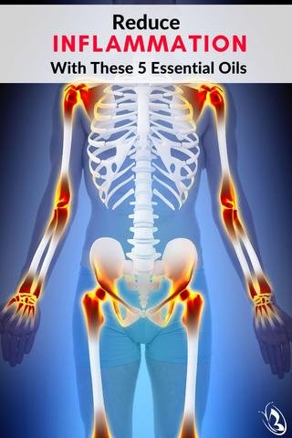 Reduce Inflammation With These 5 Essential Oils